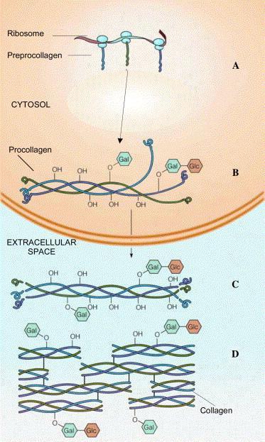 Advanced Glycation End products μπορεί να ελαττώσουν την οστική αντοχή Μπορεί να ελαττώσουν pyridinium crosslinks1 Μειώνουν τις μηχανικές ικανότητες του