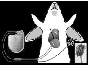 Shocks after VT/VF contribute to intracellular Ca ++