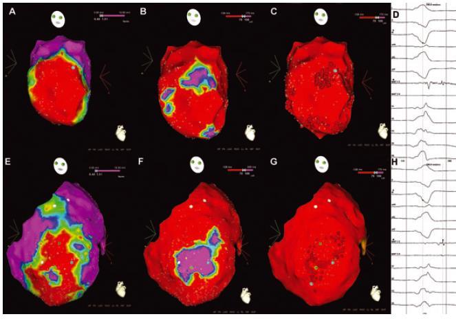 Electrophysiol