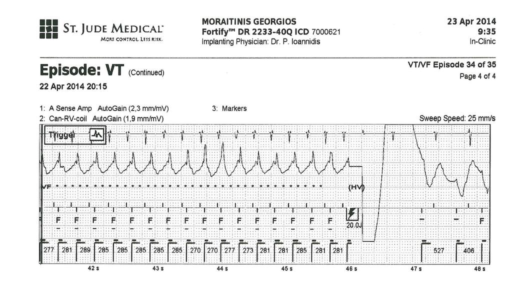 The patient with ICD