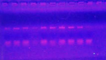 Τα προϊόντα της PCR έγινε ηλεκτροφορήθηκαν σε πηκτή αγαρόζης 2% (Εικόνα 23). Εικόνα 23.