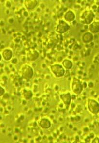 ميزان زنده بودن سلولهاي بدست آمده با روش تريپان بلو: پس از تهيه سوسپانسيون سلولي 20 ميكروليتر از اين سوسپانسيون را با 20 ميكروليتر تريپان بلو مخلوط كرده سپس بر روي لام ني وبار قرار داديم.