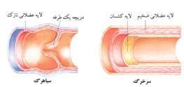 جدار رگ های خونی شکل 0-7 مقایسه جدار سرخرگها با سیاهرگها قلب خون را از میان رگهای بدن با میزانهای متغیر بسته به احتیاجات بدن به جلو میراند.