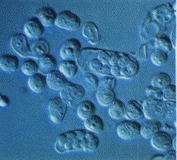 Microscopio de contraste diferencial de interferencia (DIC) é