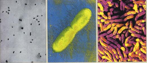 E.coli M.
