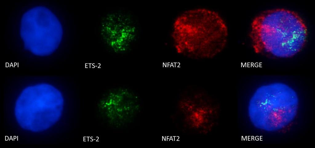 συνεντοπισμός των μεταγραφικών παραγόντων Ets-2 και NFAT, στα υπο εξέταση κύτταρα.