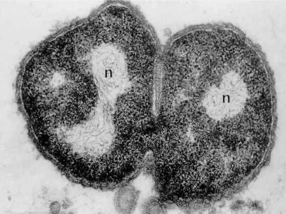 Prokariotu šūnu uzbūve Šūnu veidi-7 Neisseria gonorrhoeae šūnās redzams gaišs DNS saturošs reăions (n) un citoplazma pildīta ar