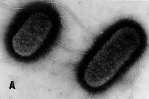Šūnu veidi-8 Prokariotu šūnu uzbūve E. coli šūnās redzamasīsas pillas un garas viciħas.