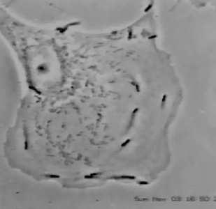 Eikariotu šūnas uzbūve 8 Listeria sp.