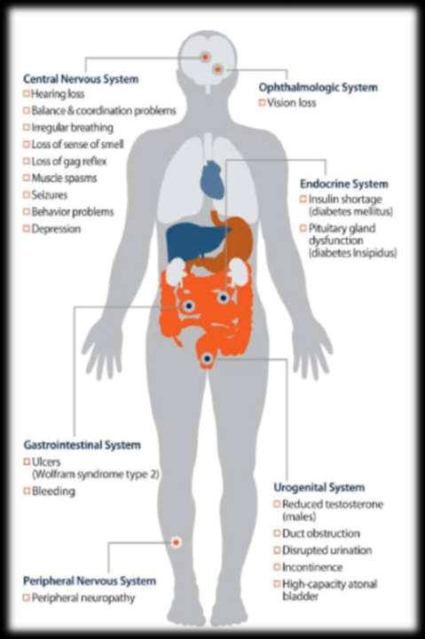 Είναι γνωστό και ως DIDMOAD (Diabetes Insipidus Diabetes Mellitus Optic Atrophy and Deafness) Σπάνια προοδευτική νευροεκφυλιστική διαταραχή Κληρονομείται με τον υπολειπόμενο αυτοσωμικό χαρακτήρα.