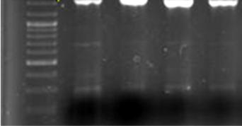 . Lactobacillus casei Lactobacillus casei Blastn -2 Sequence lenghts 52bp 52bp 52bp 522bp 522bp 522bp Most closely related type strain Lactobacillus casei strain Shirota Lactobacillus casei strain