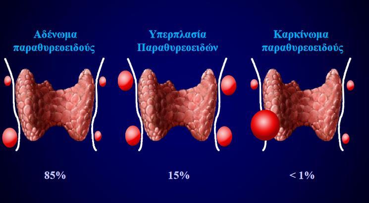 ΙΣΤΟΠΑΘΟΛΟΓΙΑ Α ΘΟΥΣ