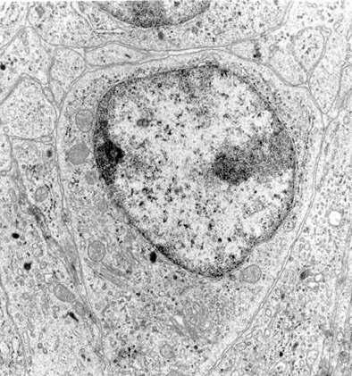 Fibra cromatina de 100Å ou colar de perlas: Atópase no núcleo da célula eucariótica en interfase. O ADN asóciase con proteínas histonas formando unha estructura denominada nucleosoma.