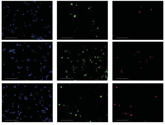 In the presence of serum, 10 mm Oleocanthal induced a maximum 10% inhibition of ASM activity LeGendre et al, Molecular & Cellular Oncology 2014 11.