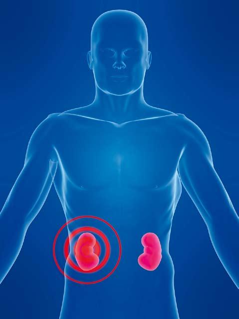 Dijagnostički postupci u urologiji NAPAD NA BOLEST SA SVIH STRANA Većina dijagnostičkih pretraga radi se u sklopu prijeoperacijske pripreme bolesnika ili njegovog poslijeoperacijskog praćenja.