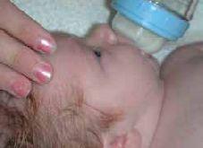 Αποτελούν οι γύψοι πρόβλημα για την υπόλοιπη ιατρική φροντίδα του παιδιού μου; H παρουσία των γύψων δεν εμποδίζει το ζύγισμα του μωρού, την διενέργεια της εξέτασης φαινυλκαιτονουρίας καθώς και των