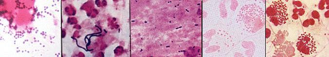 CARACTERISTICA GENERALĂ A GRUPULUI COCILOR PIOGENI MICROBIOLOGIA ŞI DIAGNOSTICUL DE LABORATOR AL INFECŢIILOR STAFILO- ŞI STREPTOCOCICE Familia Staphylococcaceae Genuri: Staphylococcus Gemella