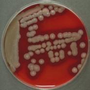 Streptococi beta-hemolitici (hemoliză completă, zonă clară în jurul coloniilor) - Streptococi nehemolitici (gammahemoliză) 2.