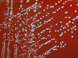 W). Streptococii care nu posedă acest Ag nu se încadrează în clasificarea Lancefield (ex.: S.pneumoniae).