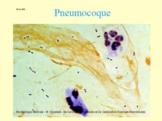 Streptococii din grupul D (S.bovis, S.