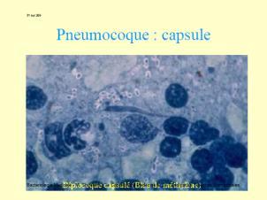 Rol în patologia umană: endocardite, septicemii neonatale, cholecistite, peritonite,