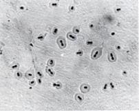 Streptococcus pneumoniae - Caractere morfo-tinctoriale: diplococi ovoizi sau