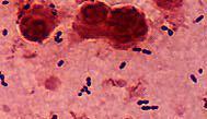 Acidul lipoteichoic (implicat în reacţii inflamatoare cu semne generale şi leziuni tisulare, posibil şoc) 5. Autolizinele (eliberarea unor factori bacterieni cu rol în virulenţă) 6.