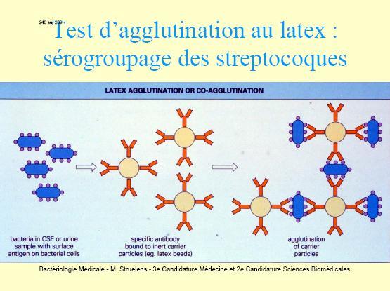 2. Diagnosticul indirect (util în infecţii poststreptococice) - Evidenţierea Ac ASLO în cazul RAA (titru diagnostic > 200 UA/ml) - Ac antistreptodornază B (titru diagnostic > 240 UA/ml) +