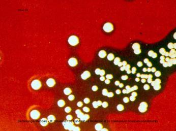 Factori structurali: - peptidoglicanul (induce secreţia citokinelor de către celulele limfocitare, responsabile de starea de şoc) - acizii lipoteichoici (induc o stare de hipersensibilitate