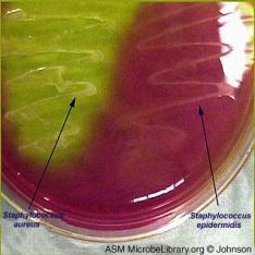 aureus pe diverse molecule plasmatice ale gazdei, ulterior adeziunea la ţesuturi: a) Proteine fixatoare de fibronectină şi laminină.