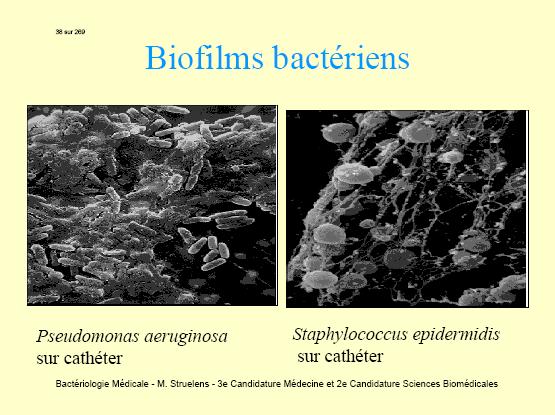 epidermidis determină infecţii asociate cu un corp străin (proteze,
