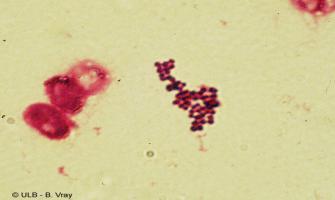 Detalii in GHID) Materiale de examinat în funcţie de forma clinică (puroi, urină, sânge, LCR, etc) 1. Diagnostic direct - Examen microscopic (Gram, RIF) - Examen bacteriologic.