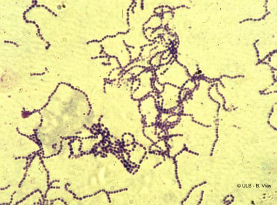 Genul Lactococcus