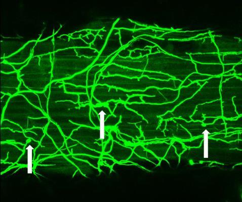 κύτταρα της επιδερμίδας, οι οποίες είναι ενδεικτικές σημείων εισχώρησης εντός των κυττάρων (Εικόνα 4.16).