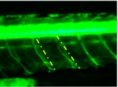 15 Table 4 Promotion effect of RZP on peripheral motor neuron