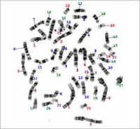 2. kromosomske mutacije -odlom dela kromosoma (delecija) -podvojitev dela kromosoma (duplikacija) -zamenjava dela kromosoma (inverzija) -premestitev dela kromosoma na drug kromosom (translokacija) 3.