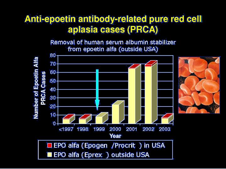 Aπλασία ερυθρών αιµοσφαιρίων (Pure Red Cell Aplasia,