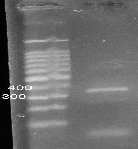 نظری مقدم همکاران فرااني ملکلي بتاالکتاماز VEB در اسينتباکتر بماني نتایج بدست آمده در بررسی نمدار 8: درصد مقامت مشاهده شده در بين ایزله های جدا شده از بيماران VEB تکنیک PCR به سیله با استفاده از