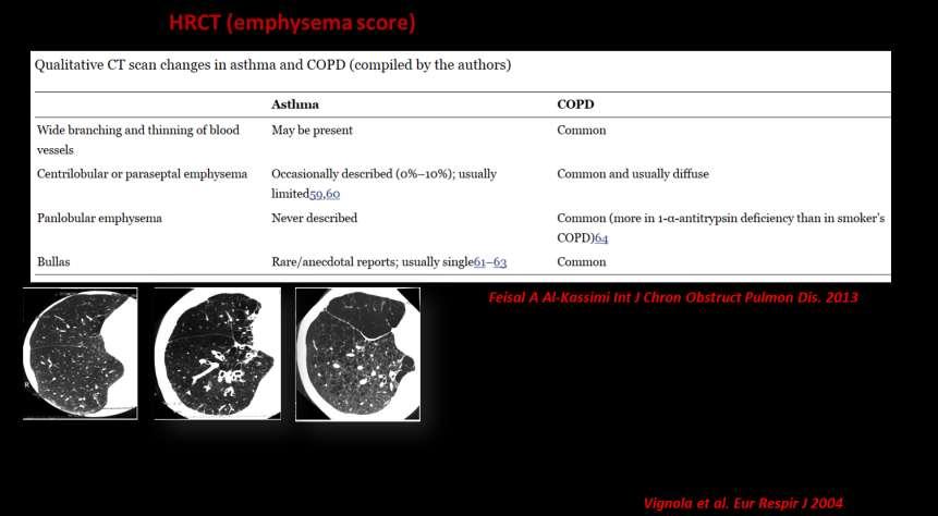 Asthma COPD Overlap (ACO) ΧΑΠ και βρογχικό άσθμα, ACOS ή ACO ή..chaos?