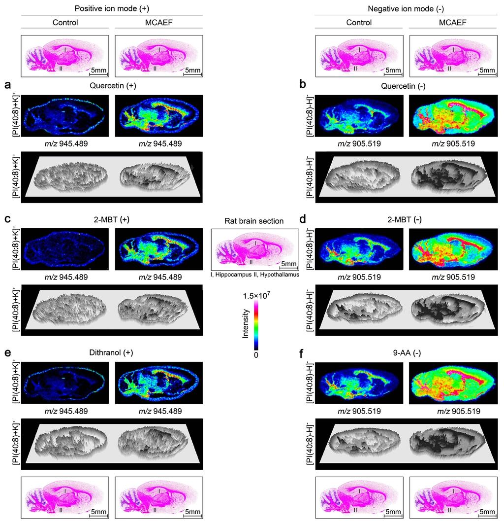 Supplementary Information Figure S5. Comparison of PI(40:8) signals across sagittal tissue sections of a rat brain, as detected by MALDIFTICR MS, with and without.