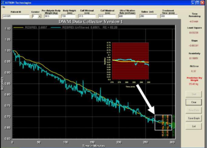 Calf bioimpedance spectroscopy monitor calf resistance and resistivity continuously during HD.