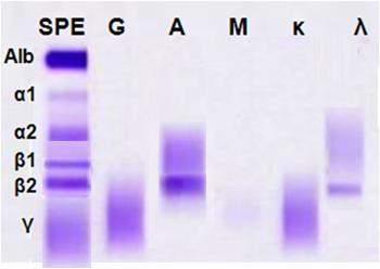 β-σφαιρίνες), είναι δύσκολο ή αδύνατο να γίνει διάκριση μεταξύ τους και να υπολογησθεί ποσοτικά, γιαυτό συνιστάται: IFE για προσδιορισμό