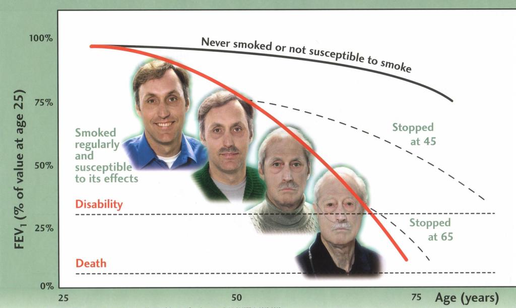 The Fletcher DIAGRAM Αλλαγές της