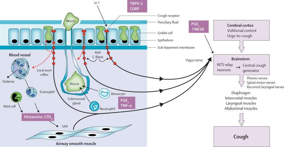 Irritant receptors: