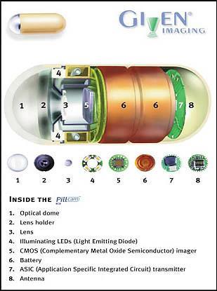 Ενδοσκόπηση με Κάψουλα Ενδοσκόπηση με κάψουλα Πρώτη χρήση στον άνθρωπο το 1999.