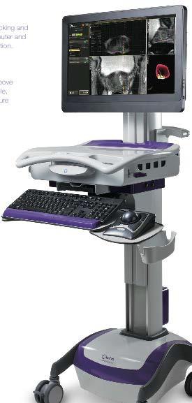 15/1/2018 Biopsee Uronav: Philips Artemis: