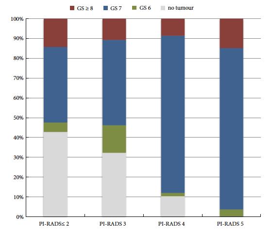 systematic PBx, the detection rate of PCa was 90% (94/105) in fusion PBx alone and 68%