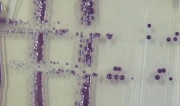 На храњивој подлози SPА, три дана након извршене изолације образују се пљоснате, округле до неправиле и течне колоније бисерно, крем-беле боје. Колоније бактерија су величине 0,8-1,5 mm.