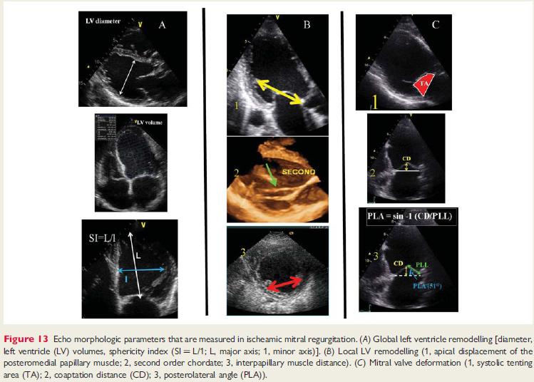 Functional MR Lancellotti P et al.