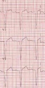 3mg/dL, GFR: 63mL/min/1.73m 2.